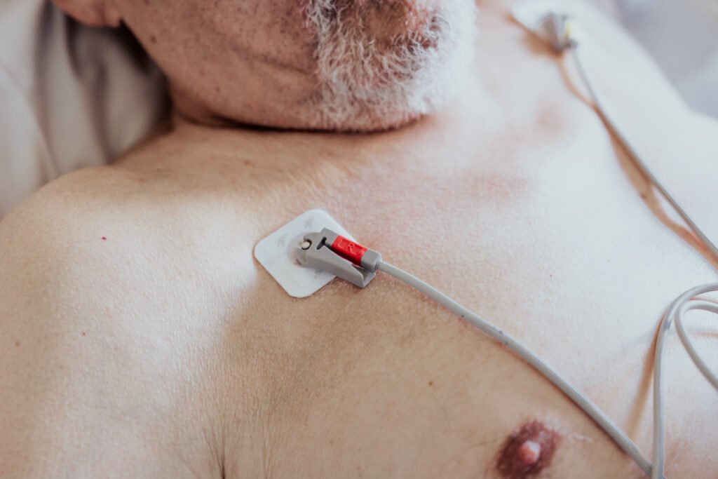 homme alité en train de passer un electrocardiogramme