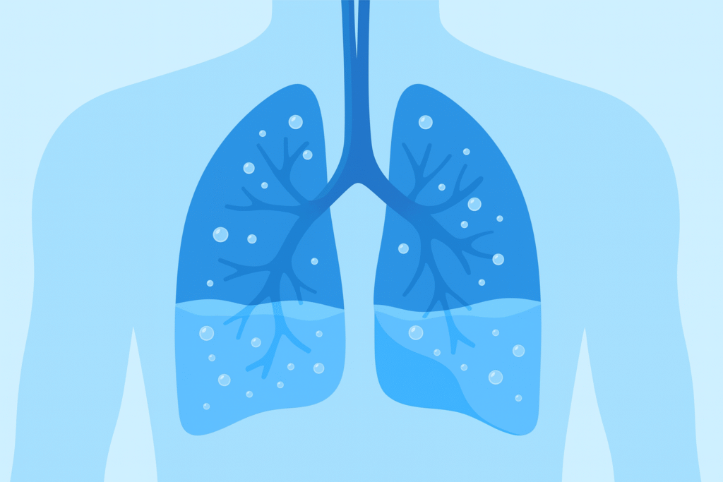 eau dans les poumons dessin