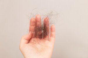 Une main pleine de cheveux fraichement tombés pouvant evoquer l'effet du stress sur la chute des cheveux