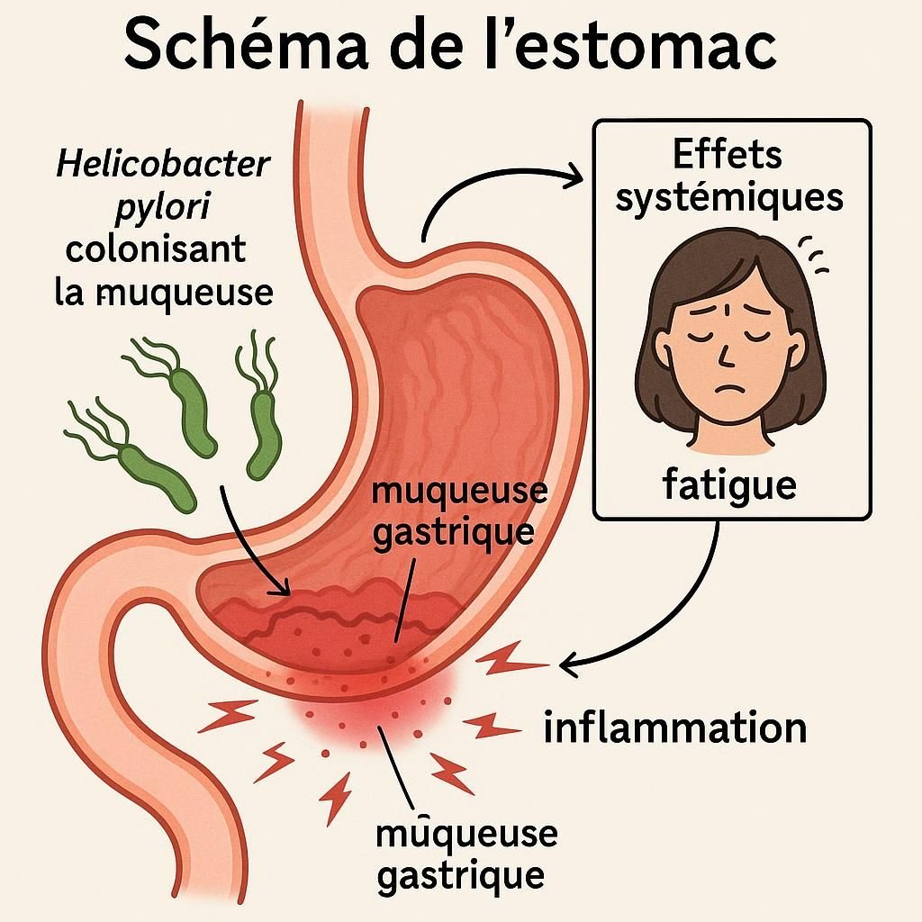 découvrez le lien possible entre helicobacter pylori et la fatigue, ses symptômes et les solutions pour améliorer votre bien-être.